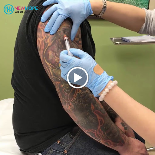 Explore outdoorsman tattoo ideas, creative tattoo ideas in Westminster, available at Newhope Laser Skin Care