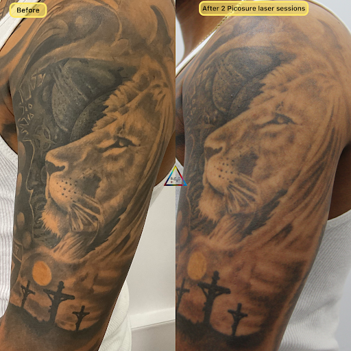 Explore tattoo ideas para mujeres, creative tattoo ideas in New York, available at Ag2g Laser Tattoo Removal & MedSpa