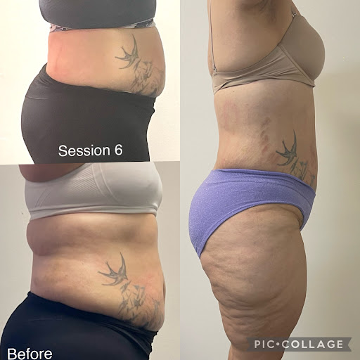 Explore medical tattoo ideas, creative tattoo ideas in Savannah, available at Haute Brows. Cosmetic Tattoo