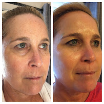 Amy Maxwell Cole Esthetics, LLC. - Photo 5 - Car repair in Fort Myers, FL, Lehigh Acres