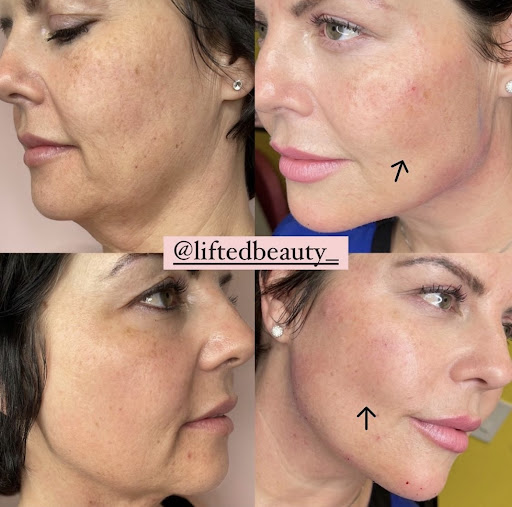 Lifted Beauty Medical Practice image