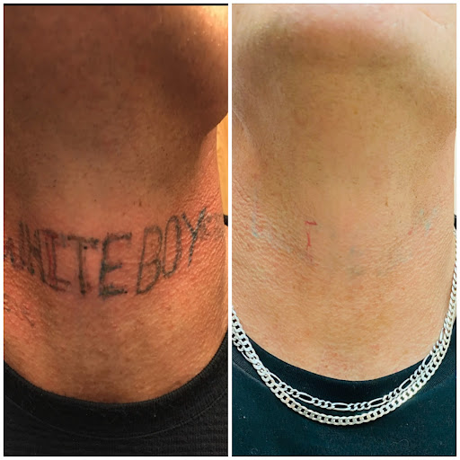 Explore tattoo ideas music lovers, creative tattoo ideas in Tucson, available at Allure Medical