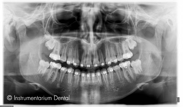 Radiografías Dentales - 3DRay El Llano - San Miguel