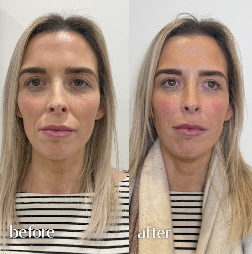 Eden Medical - Portlaoise | Dermal fillers, Lips, Cheek, Jawline Portlaoise in Portlaoise, Co. Laois (Laois)