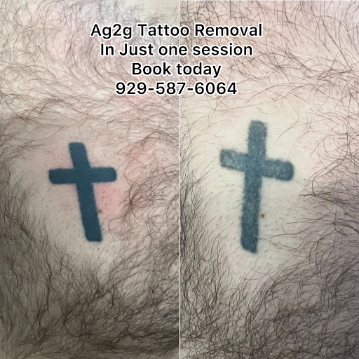 Explore unique lettering tattoo ideas, creative tattoo ideas in New York, available at Ag2g Laser Tattoo Removal & MedSpa