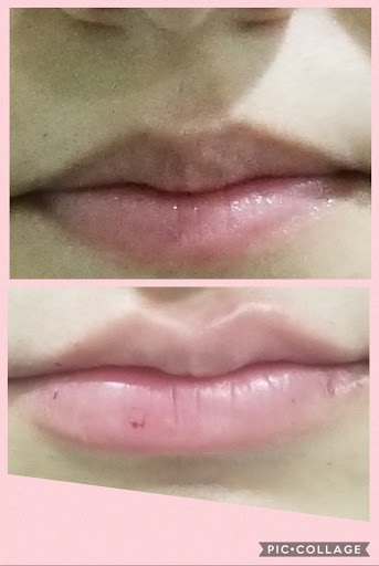 Medical Spa «New Image Medical Spa», reviews and photos, 680 Mowry Ave, Fremont, CA 94536, USA