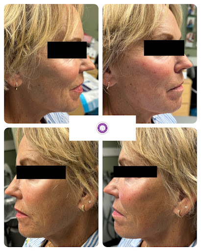 Explore arizona flag tattoo ideas, creative tattoo ideas in Brunswick, available at Brunswick Medical Aesthetics