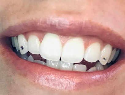 Smirk to Smile Teeth Whitening