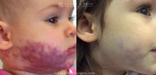 Explore charlotte's web tattoo ideas, creative tattoo ideas in Southampton, available at Laser & Skin Surgery Center of New York - Southampton