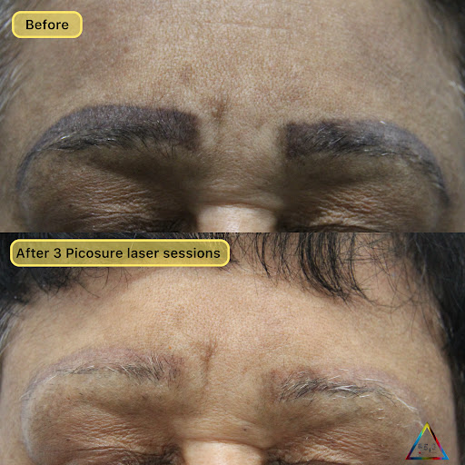 Explore birth flower tattoos ideas, creative tattoo ideas in New York, available at Ag2g Laser Tattoo Removal & MedSpa