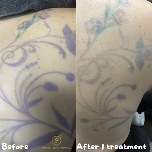 Explore bike tattoo ideas, creative tattoo ideas in Mckinney, available at Premier Tattoo Removal