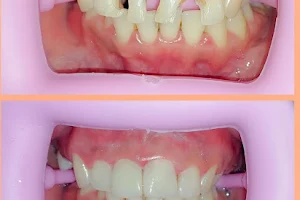 ZZ Dental Care ( Praktek Dokter Gigi Amuntai ) image