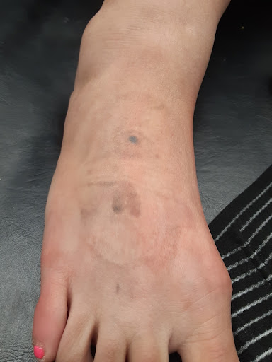 Explore photographer tattoo ideas, creative tattoo ideas in Saint Paul, available at Fearless Tattoo Removal