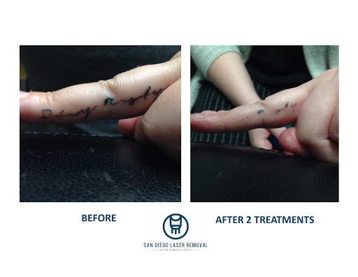 Explore tattoo ideas floral, creative tattoo ideas in San Diego, available at Removery Tattoo Removal & Fading