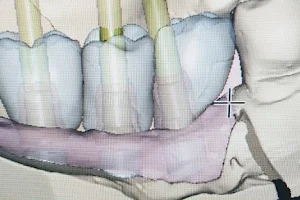 ד"ר אילן גלבוע - מרפאת מומחים בשיניים ,נתניה image