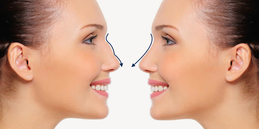 Dr Cosmetic Clinic - Dermal Fillers | Lip Fillers | Botox | Profhilo | PDO Thread Face Lift | Fat Dissolver | Eyelash Serum