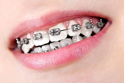Family Dental Clinic E Implantes Dentales