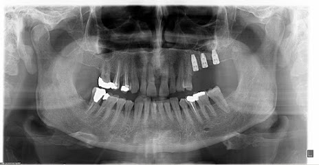 DİGİPAN MALTEPE Panoramik-Sefalometrik Röntgen 3 D Volumetrik Dental Tomografi