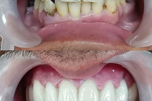 Diş hekimi Mehmet ÖZER-Alanya Diş hekimi -Diş kliniği-İmplant -Zirkonyum-Acil Diş-Kanal Tedavisi-Porselen kaplama-Dentist- image