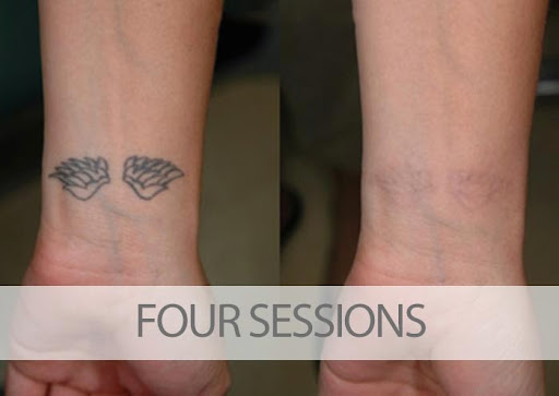 Explore moon and star tattoo ideas, creative tattoo ideas in Bradenton, available at EradiTatt Tattoo Removal of BradentonSarasota