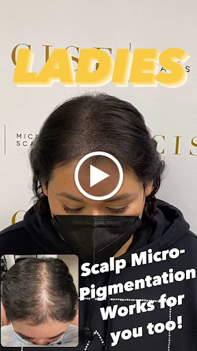 Precise Scalp Micro - Scalp Micropigmentation Service and Training image