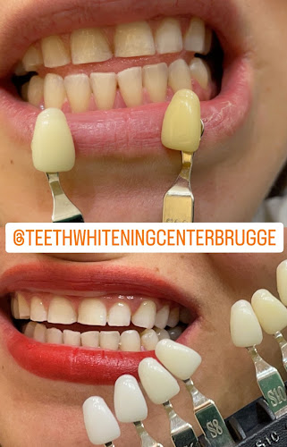 Teethwhiteningcenter.be - Tandarts