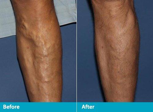 Beach Cities Vein and Laser Center image