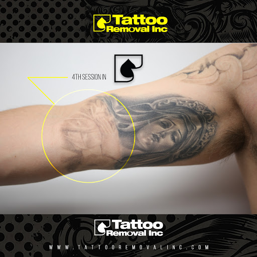 Find aquatic tattoo ideas for your next unique tattoo in South Gate at Tattoo Removal Inc