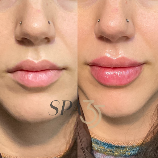 Explore mens ankle tattoo ideas, creative tattoo ideas in Boise, available at Spa 35 Med Spa