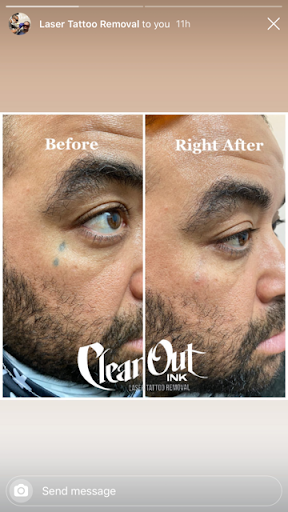 Explore green tattoo ideas, creative tattoo ideas in Cookeville, available at Clear Out Ink Laser Tattoo Removal