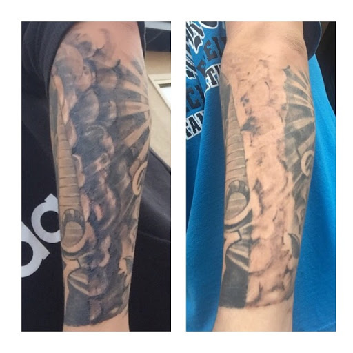 Explore tattoo position ideas, creative tattoo ideas in Albuquerque, available at ClearWaves Medical Laser Group