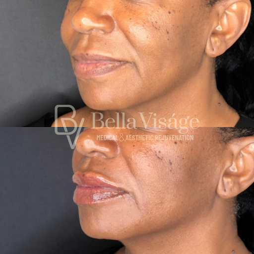 Explore rib tattoo ideas for women, creative tattoo ideas in Lakeland, available at Bella Visge Medical & Aesthetic Rejuvenation