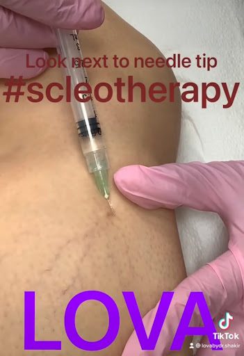 Explore jennifer tattoo ideas, creative tattoo ideas in Lake Oswego, available at Lake Oswego Vein and Aesthetic LOVA