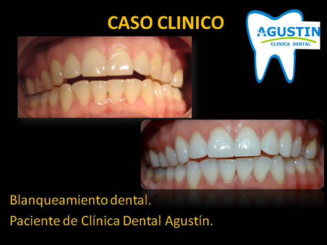 Opiniones de Clínica Dental Agustín de Cabrero Dr. Pablo Hidalgo G. en Cabrero - Dentista