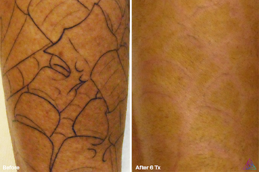 Explore mom tattoo ideas for sons, creative tattoo ideas in Rowlett, available at Bonsai Laser Tattoo Removal