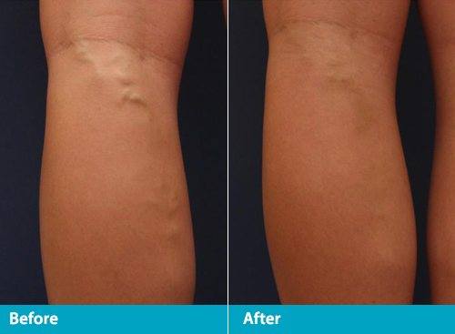 Beach Cities Vein and Laser Center image
