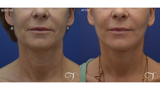 Kristina Tansavatdi, MD Tansavatdi Cosmetic & Reconstructive Surgery image