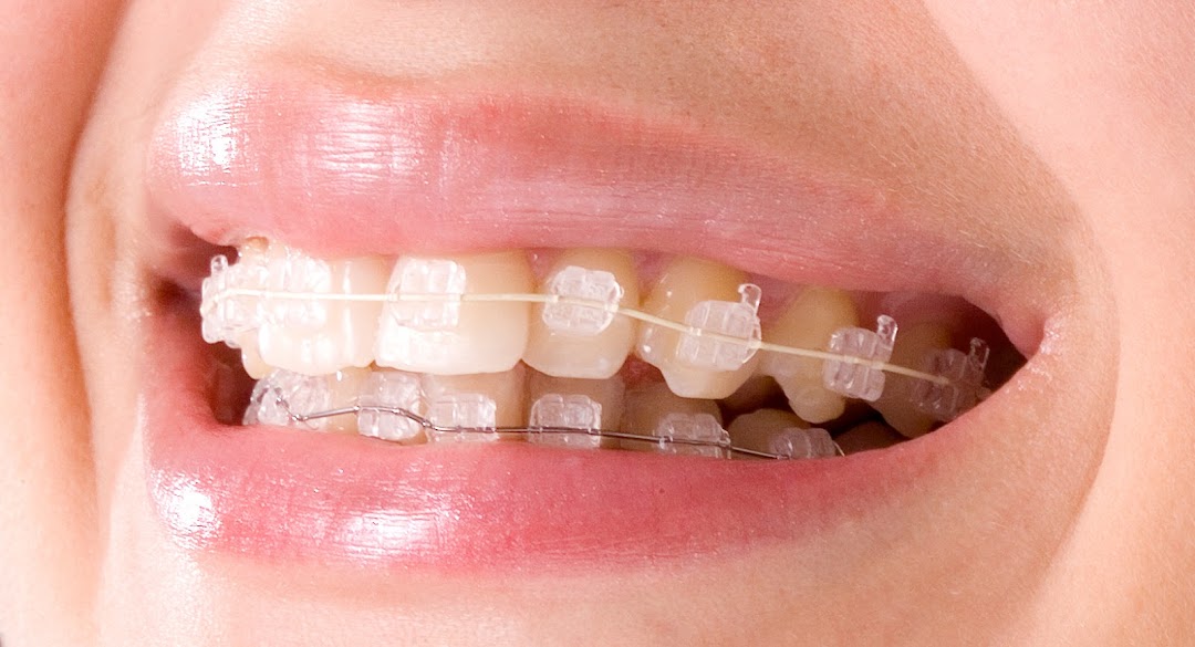 CSY International LLC