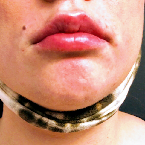 Explore tattoo ideas for roses, creative tattoo ideas in Summit, available at Ethos Aesthetics and Wellness, Laser Hair Removal and Med Spa