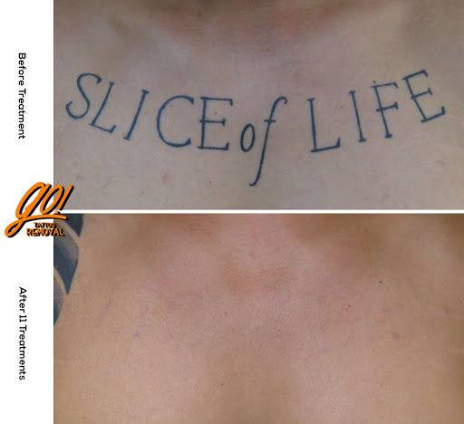 Explore tattoo cover up ideas for guys, creative tattoo ideas in Allentown, available at Removery Tattoo Removal & Fading