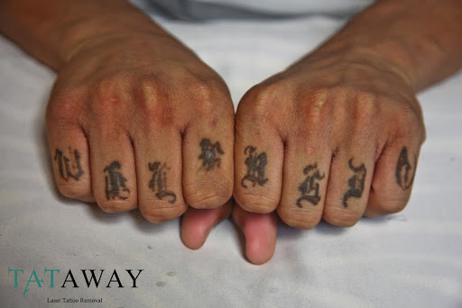 Find small sunflower tattoo ideas for your next unique tattoo in Boston at Removery Tattoo Removal & Fading