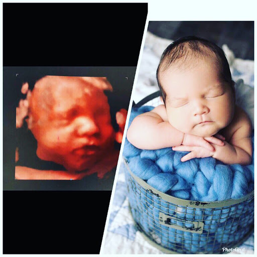 Medical Diagnostic Imaging Center «My little baby 4d & boutique», reviews and photos, 8930 TX-121, McKinney, TX 75070, USA