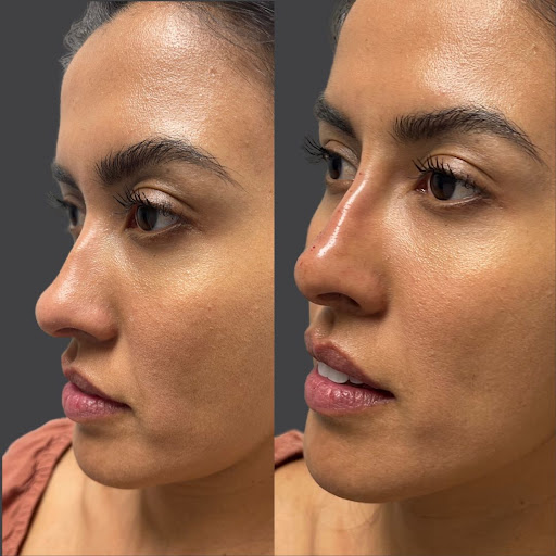 Find tattoo clock ideas for your next unique tattoo in Whittier at Skin Perfect Medical Aesthetics