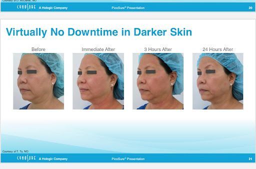 Explore tyler childers tattoo ideas, creative tattoo ideas in New York, available at Ag2g Laser Tattoo Removal & MedSpa