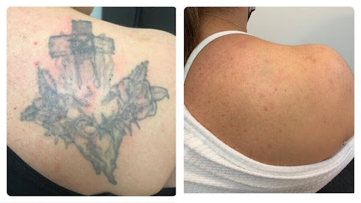 Explore tattoo ideas for carpenters, creative tattoo ideas in Houston, available at Clean Canvas Laser