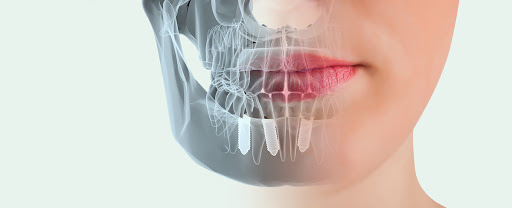 Dr. Sergio Medina Cirujano Dentista e Implantólogo Oral Especializado