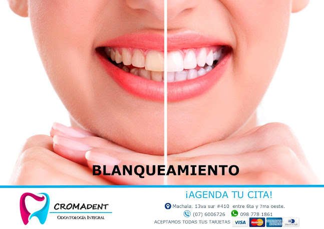 Opiniones de CromaDent en Machala - Dentista