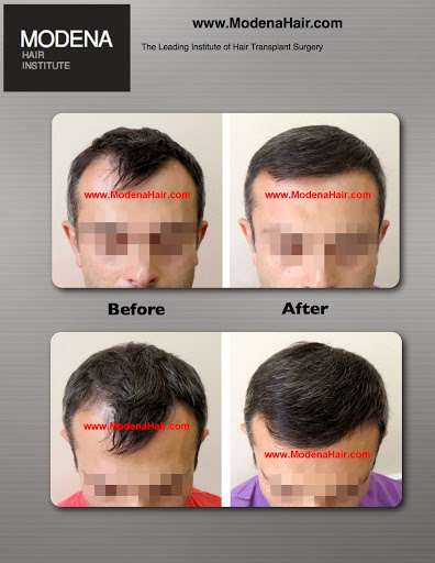Modena Hair Transplant Institute image