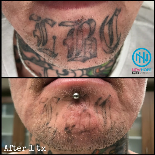 Explore puzzle tattoo ideas, creative tattoo ideas in Westminster, available at Newhope Laser Skin Care