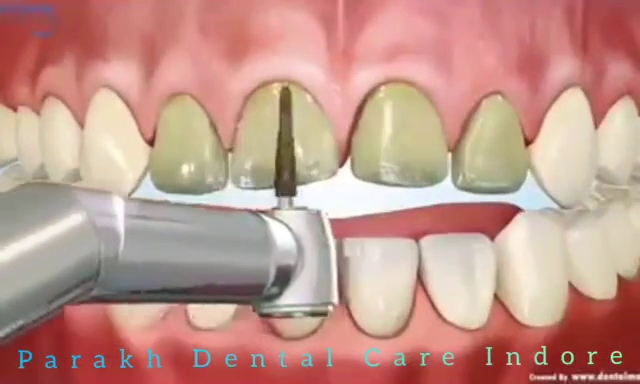 Parakh Dental Care / Dr. Manish patidar / Dr. Arti patidar